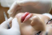 natural-vs-overdone:-what-sets-fillers-apart